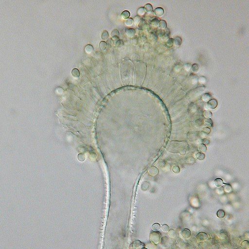 Photo of Aspergillus flavus. Credit: Medmyco, CC BY-SA 4.0 via Wikimedia Commons