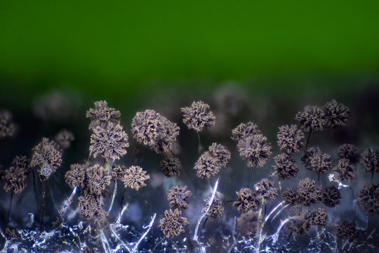 Aspergillus niger сonidium under microscope Credit: Alexander Klepnev, Wikimedia Commons
