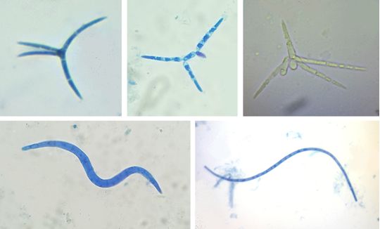 Aquatic hyphomycetes (by Fay Newbery). BMS Workshop 2026