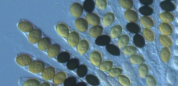 Ascospores in the asci of Sordaria macrospora. Credit Aurora Storlazzi via Wikimedia Commons