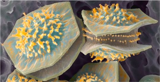 Aspergillus spinosus ascospores. Credit: Jan Dijksterhuis