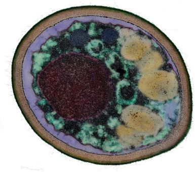 Conidium of Penicillium shortly before germination (lower right corner of the image), diam 2 μm. Transmission electron microscopy by Feng M. Cai and Irina S. Druzhinina, 2025. Image artificially coloured.