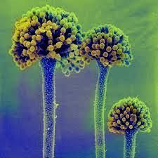 Conidial heads of Aspergillus fungus